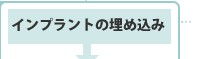 インプラントの埋め込み